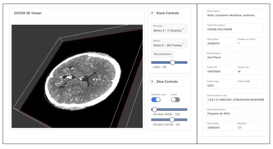 Brain CT in database